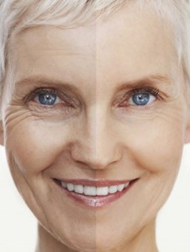 DNA Code®-No Needle Alternative-Pure Argireline Peptides Winkle Reduce Cream-Hyaluronic Acid+ Matrixyl 3000