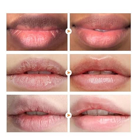 Lip Lightening for Dark Lips Lip Brightener for Smokers Dark Lip Treatment Lightening Cream for Pink Lips Lip Lightener for Smoker Lips Lip Lightening Beauty and Personal Care Rocet