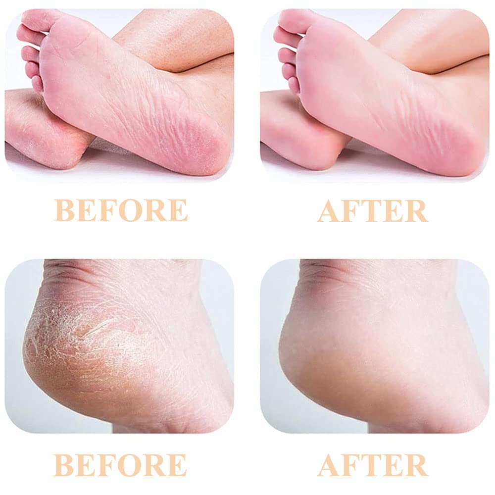 PAI4LEISI 6 Pcs Pedicures Replacement Heads for Flawless Pedi Electric Tool Foot File,Pedi Replacement Roller Head fit Finishing Touch Flawless Pedi