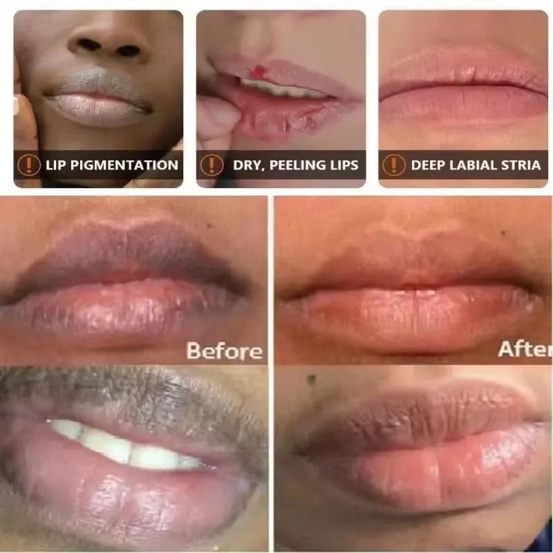 2PCS Natural Plant Lip Balm for Dark Lips,Exfoliating Lip Scrub, Moisturizing Lip Hyaluronic Acid Exfoliating Dead Skin, Lip Balm for Smokers, Restore