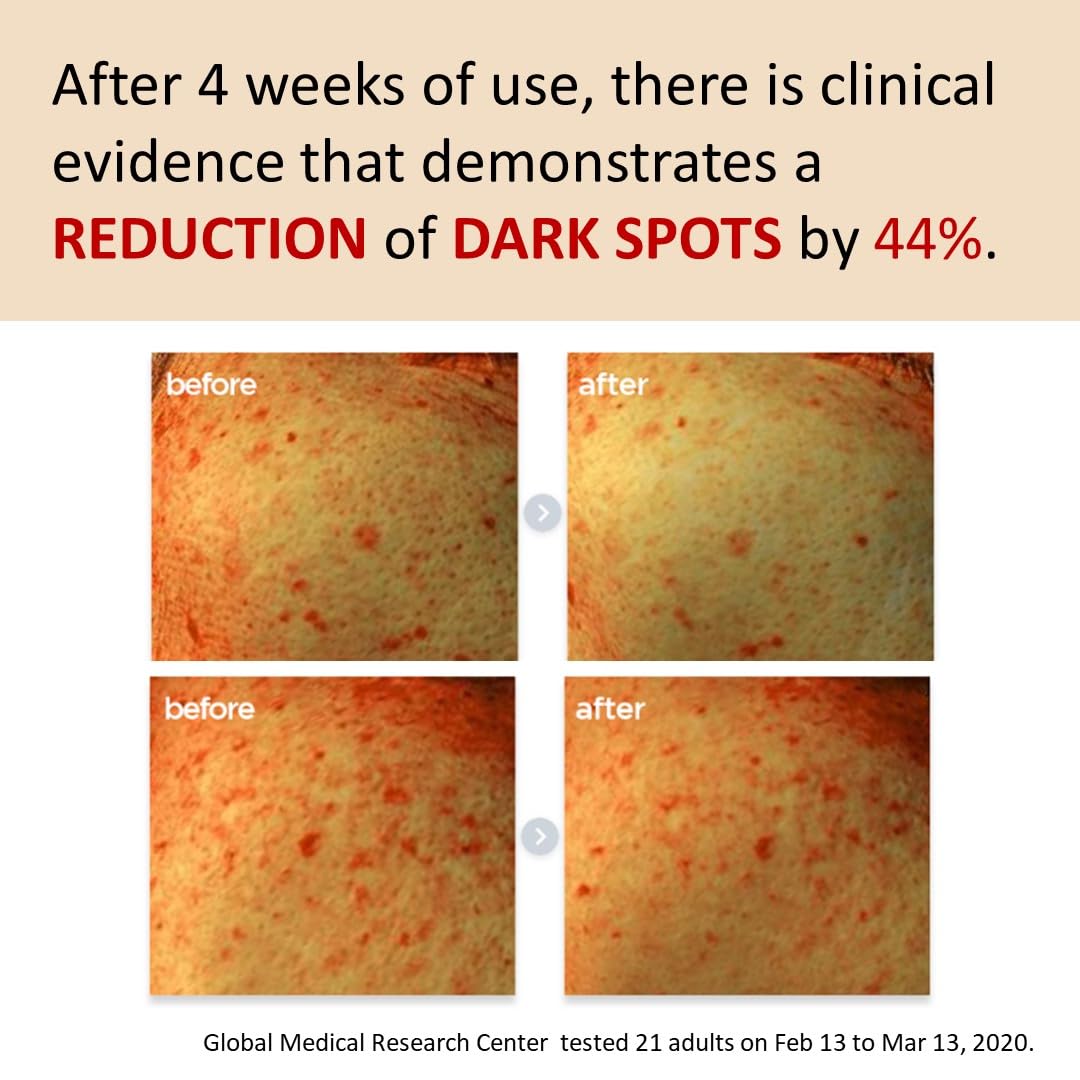 [Make p:rem] Poncirus trifoliata C Dark spot serum | Skin clearing serum | Uneven Skin Tone Treatment | Vitamin serum C face | 40ml, 1.35 fl.oz. | Beauty & Personal Care MAKEP:REM