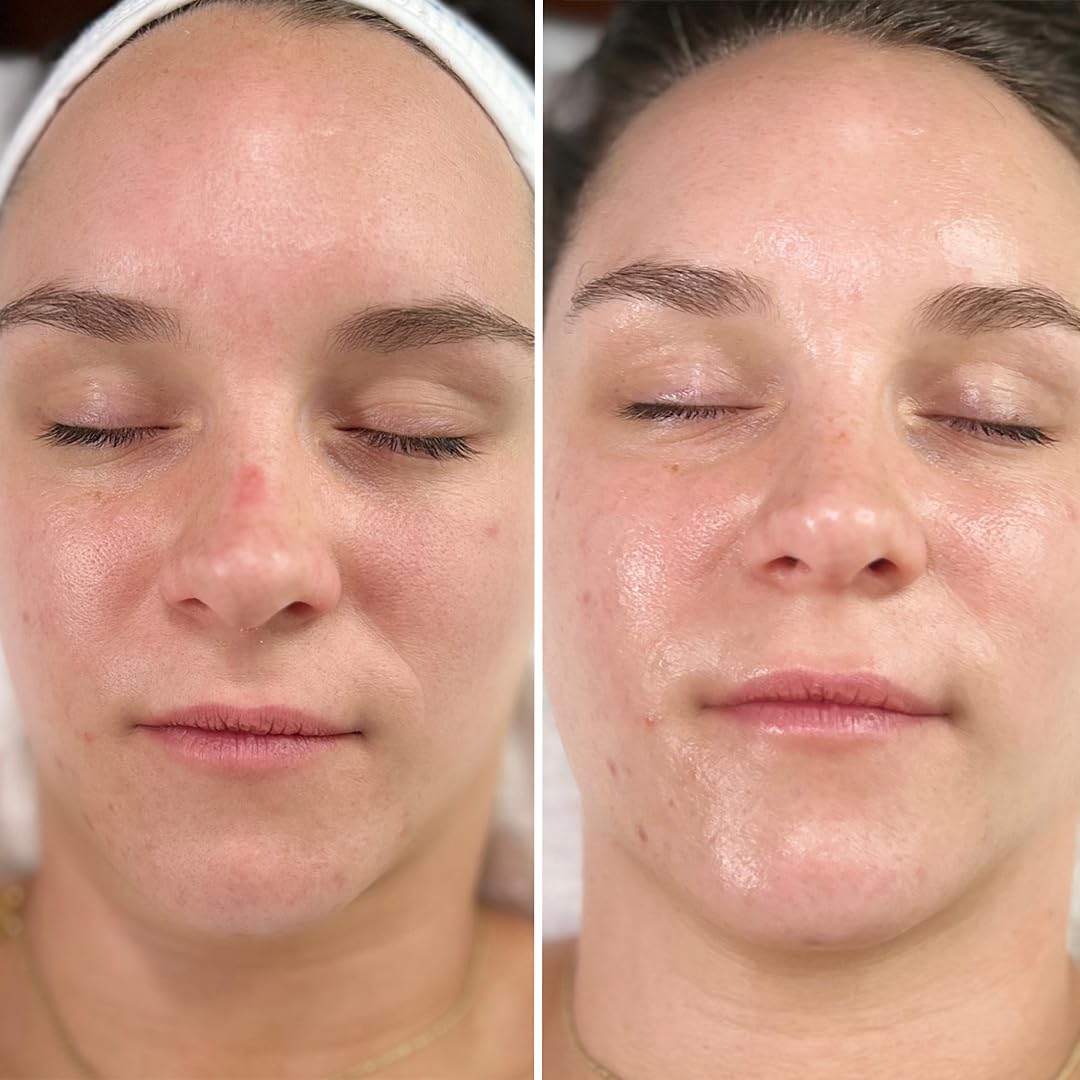 Intraceuticals Rejuvenate Daily Serum