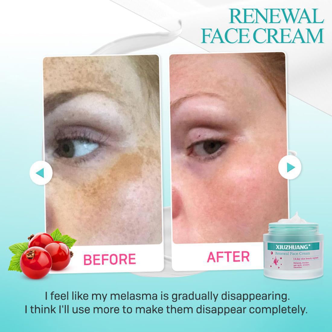 XIUZHUANG Gentle Non-irritating moisturizer face cream for Women - Treats Melasma freckles Dark Spots Shrinks pores Nourishing Facial Care-1.46 fl oz