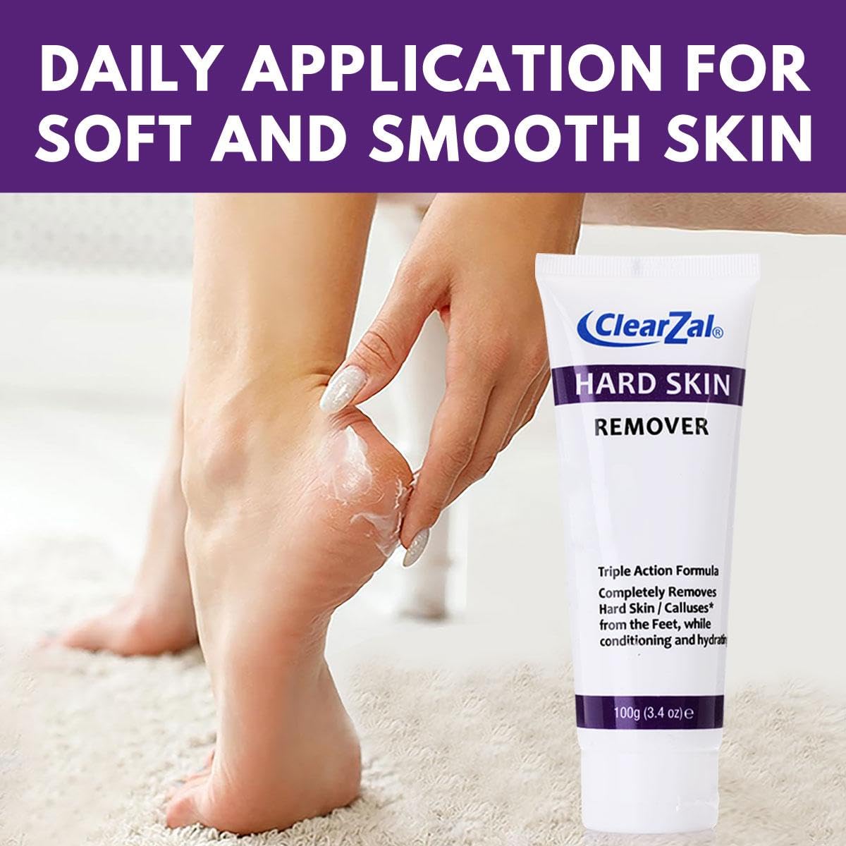 Clearzal Foot Cream For Hard Skin, Helps Calluses and Corn Removal While Leaving Soft Smooth Skin, Hydrating and Conditioning Triple Action Formula