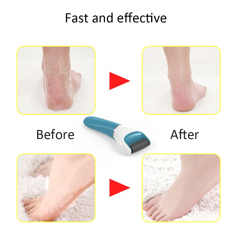 Electric Foot File Callus Remover Professional, 2-Speed Rechargeable Pedicure Tool for Remove Calluses, Dry, Hard, Dead, Cracked Skin, Includes 2