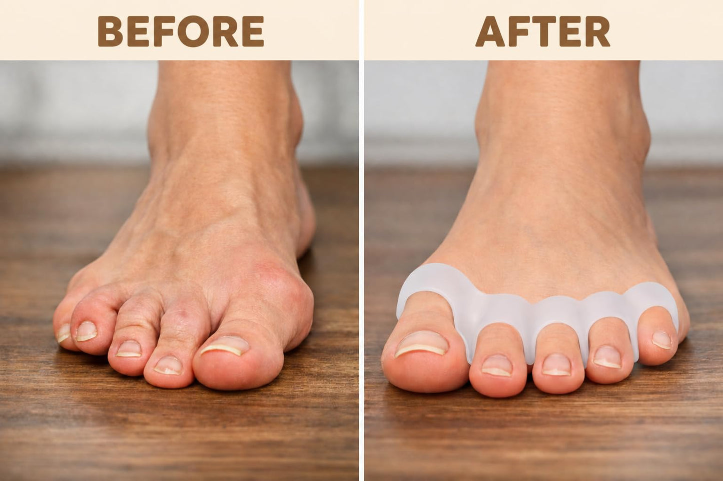 Toe Spacers for Women and Men, Bunion Corrector, Hammertoe Straightener and Plantar Fasciitis Relief, Latex-Free Medical-Grade Silicone Toe Separators Beauty & Personal Care Yoga Trapeze
