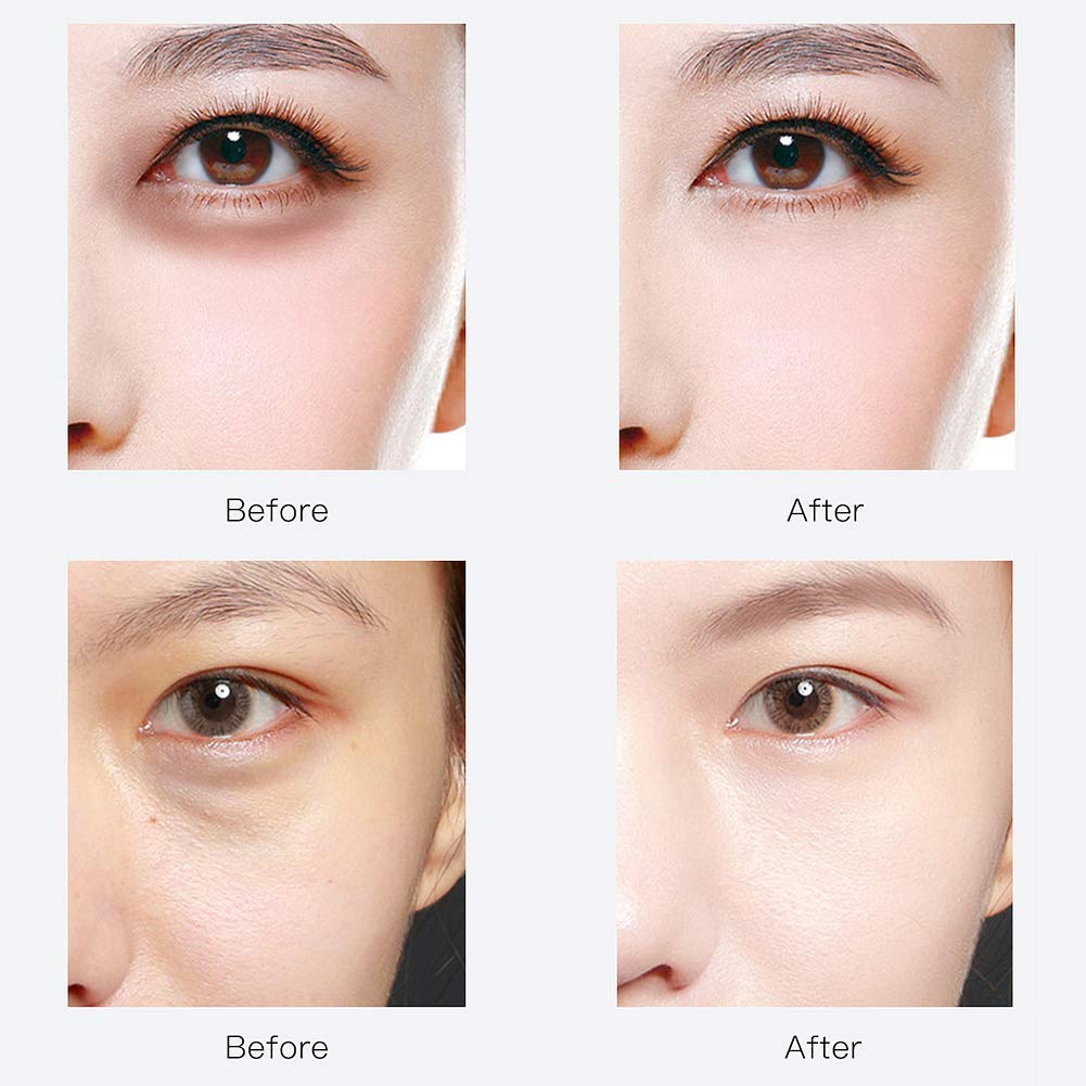 RABIOTA Under Eye Patches,30 pairs Hyaluronic Acid Anti-Aging Under Eye Mask, Collagen Under Eye Gel Pads for Dark Circles, Wrinkles, Fine Line