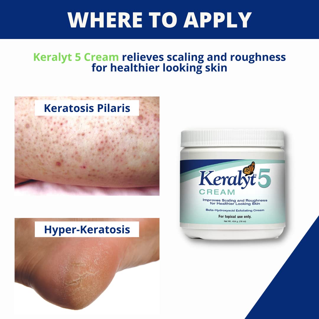 Keralyt 5 Psoriasis Cream - Full Body 5% Salicylic Acid Exfoliating Skin Lotion - Promotes Relief from Itchy, Redness, Dryness, Roughness, and Flakey