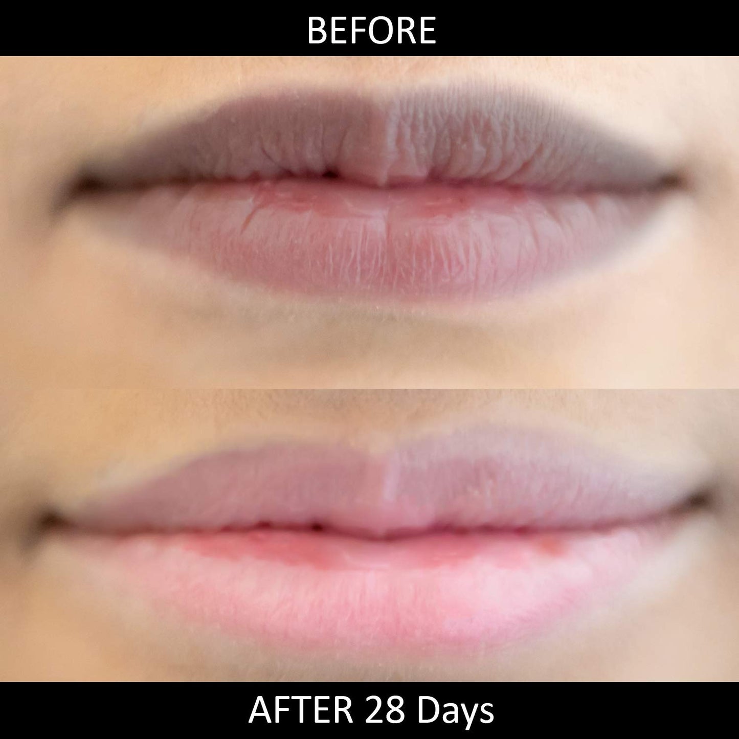 Lip Lightening Salve by Omorfee- Lip Balm for Dark Lips with SPF Protection - Natural Lip Repair & Deep Hydration - Cocoa Butter, Carrot Seed Oil Beauty and Personal Care OMORFEE BE EXOTIC OF