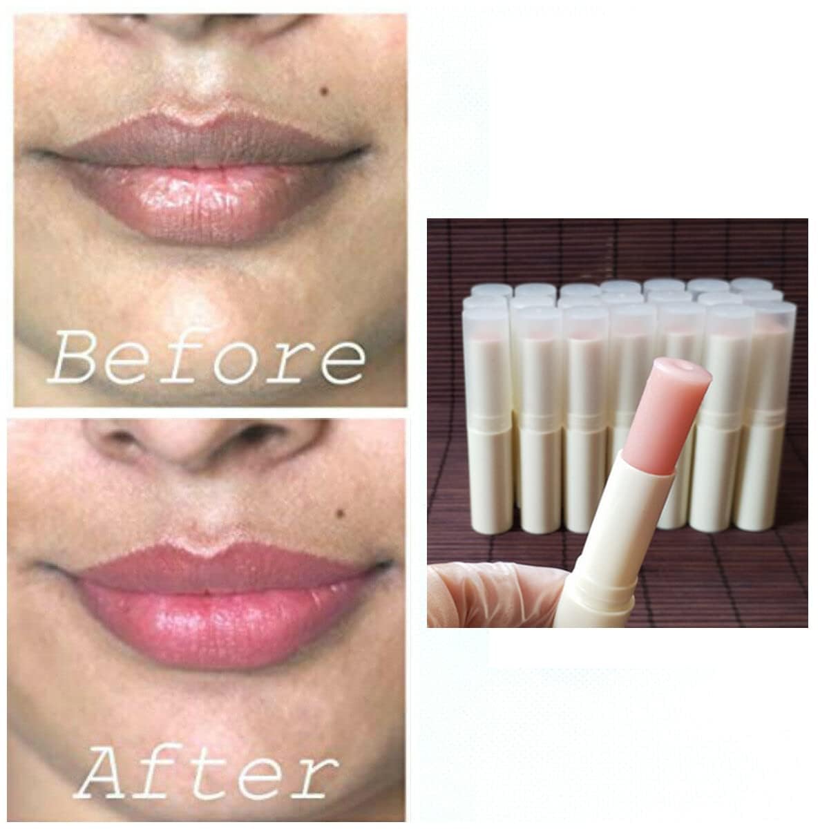 2PCS Natural Plant Lip Balm for Dark Lips,Exfoliating Lip Scrub, Moisturizing Lip Hyaluronic Acid Exfoliating Dead Skin, Lip Balm for Smokers, Restore