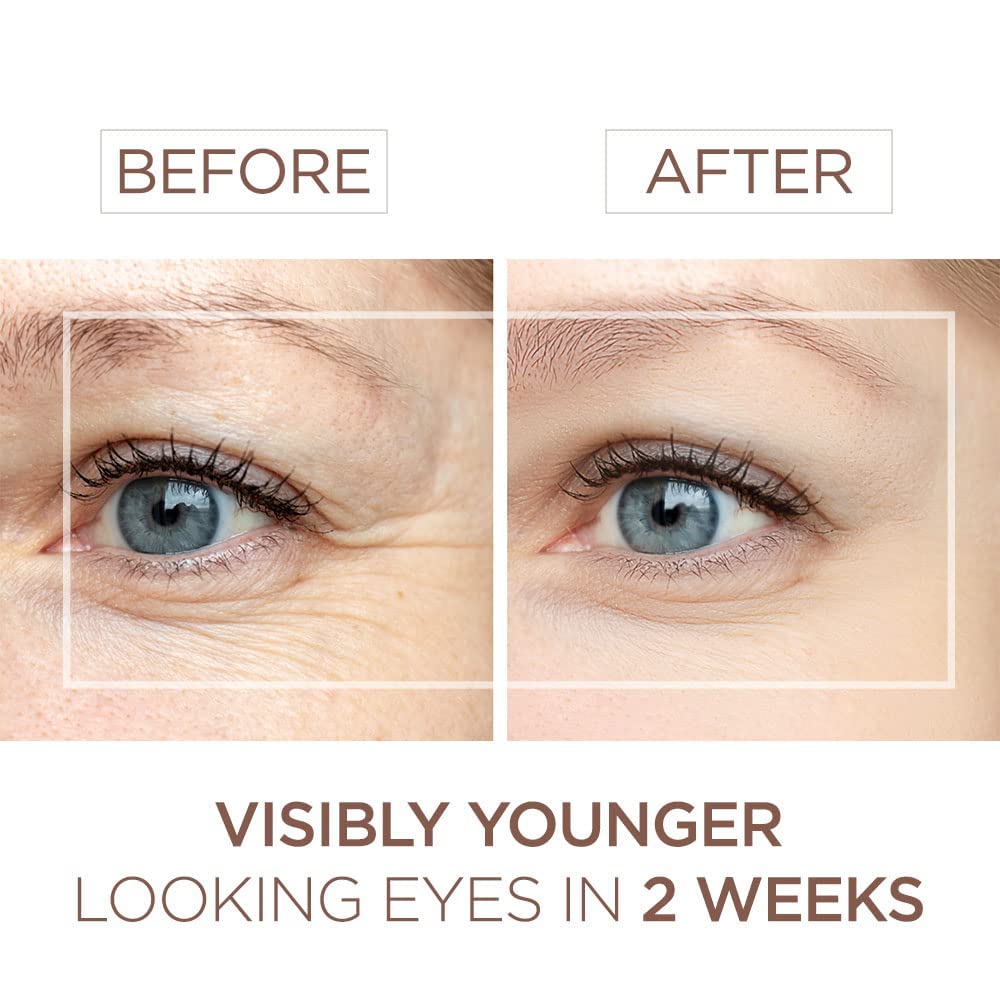 BEE and YOU Eye Serum, Anti Aging, Anti Wrinkle Serum 100% Natural with Bee Venom, Propolis Extract, Raw Honey, Hyaluronic Acid, For Dark Circles