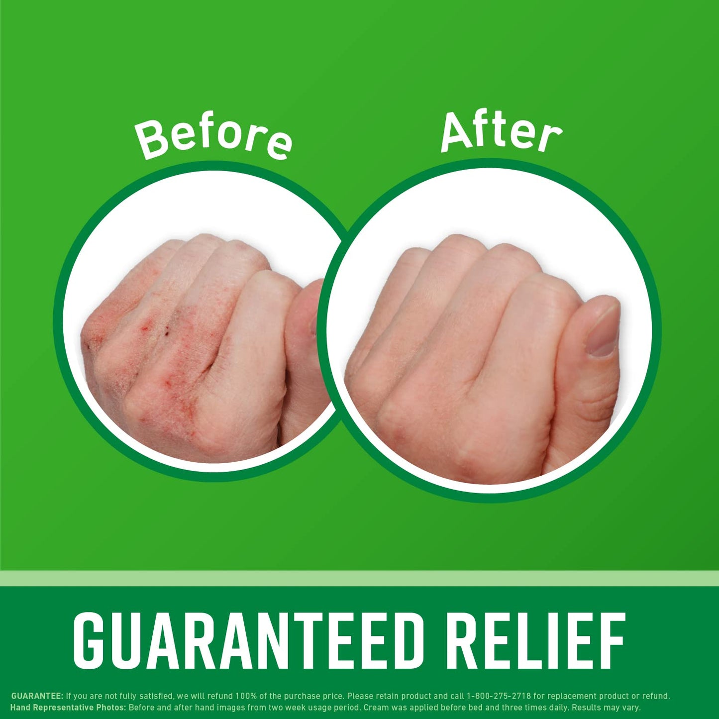 O'Keeffe's Working Hands Hand Cream (3.4 oz Jar) and Healthy Feet Foot Cream (3.2 oz Jar) - Repairing Skincare for Extremely Dry, Cracked Hands