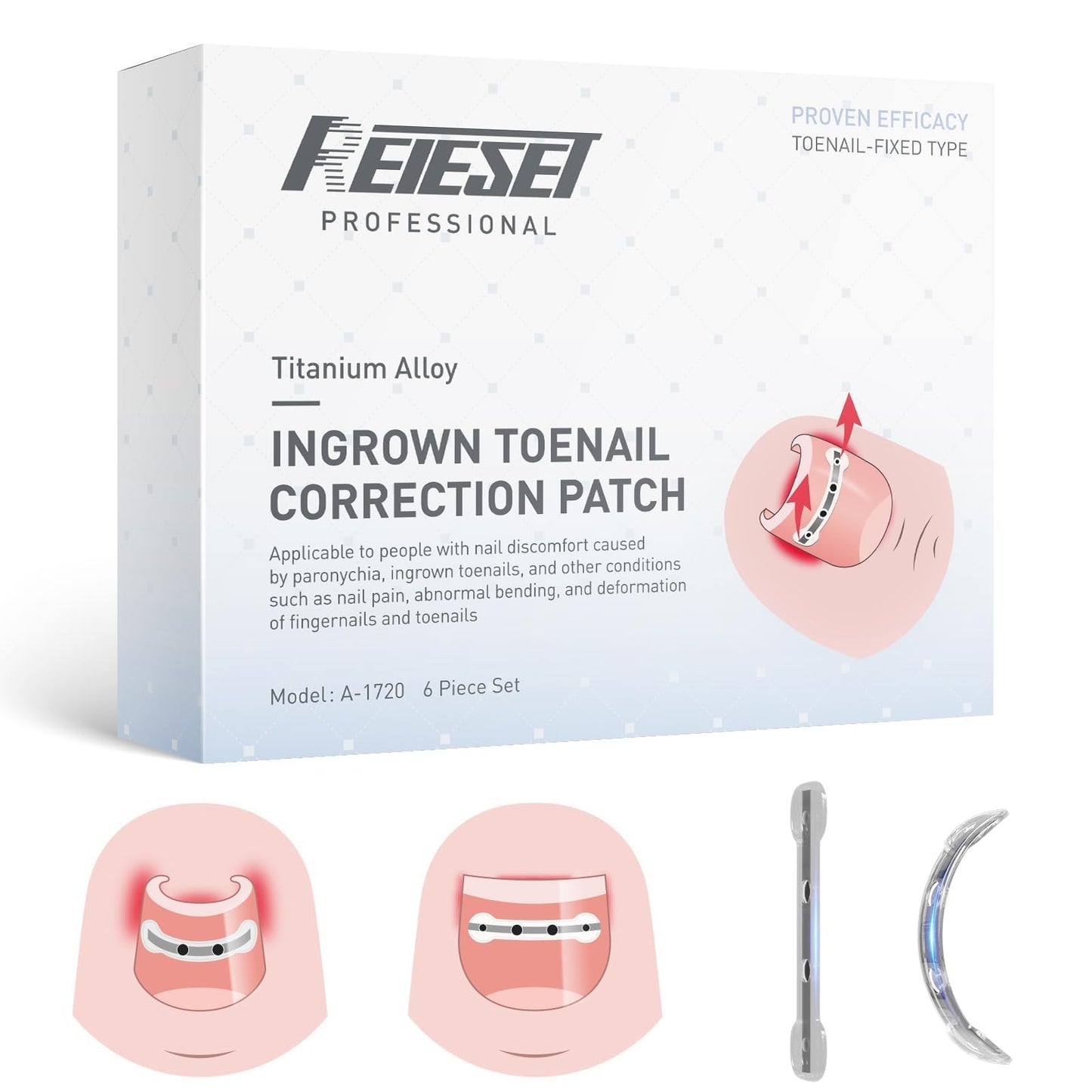 Reieset Titanium Alloy Ingrown Toenail Treatment, Nail Tools, and Ingrown Toenail Removal Kit Specially Designed for Curved Nail Repair and Ingrown Beauty and Personal Care Reieset Default Title