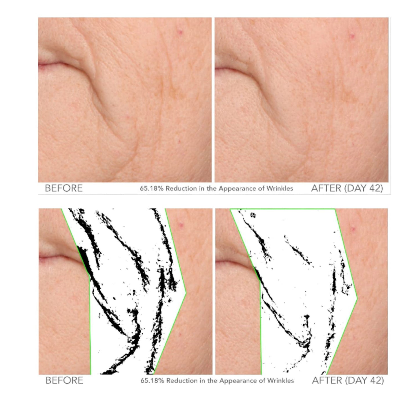 Serious Skincare - Beyond Intensive Vitamin C Serum for Face - 60 Day Facial Treatment for Healthy Glowing Skin and Brightening - Smoothes Lines