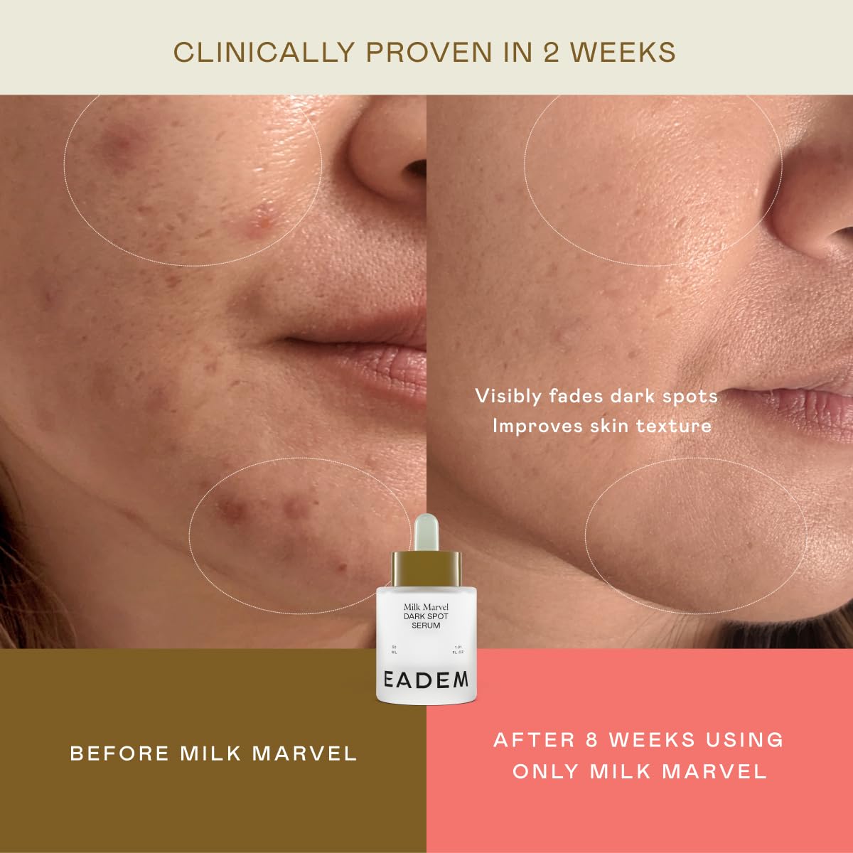 EADEM Milk Marvel Dark Spot Serum, Vitamin C Face Serum Infused with Niacinamide, Dark Spot Remover for Face and Body, Natural Dark Spot Corrector