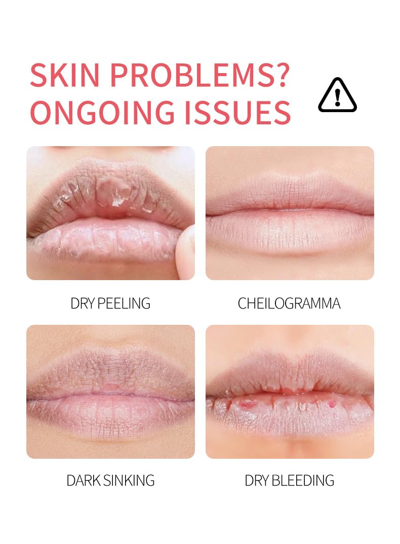 8 - piece Fruity Lip Mask Set! Paired with Lip Balm for Long - lasting Moisturization