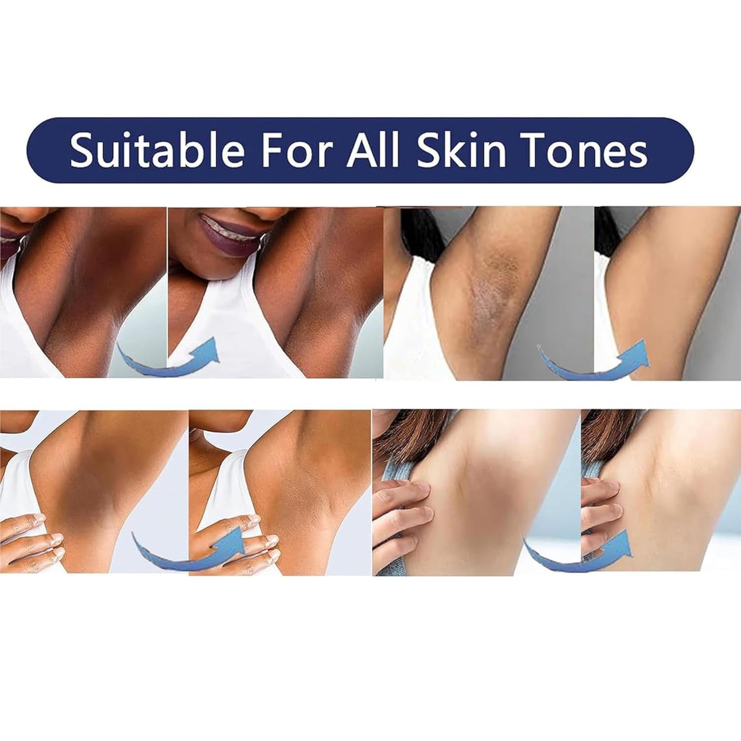 Vcetree Skin Bleaching Cream Skin Lightening for Body Intimate Areas, Private Parts, Underarm, Knees, Elbows, Inner Thigh, Bikini Area, Whitening Beauty and Personal Care Vcetree