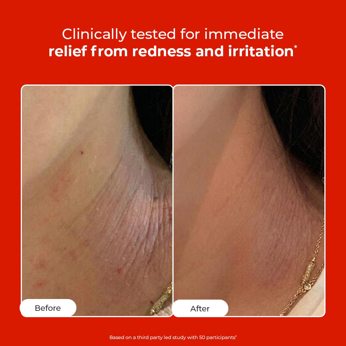 Conscious Chemist HOCL Skin Relief Face & Body Spray Soothing & Repairing Toner Hypochlorous Acid Mist for Quick Relief from Body Odour,Acne, Redness