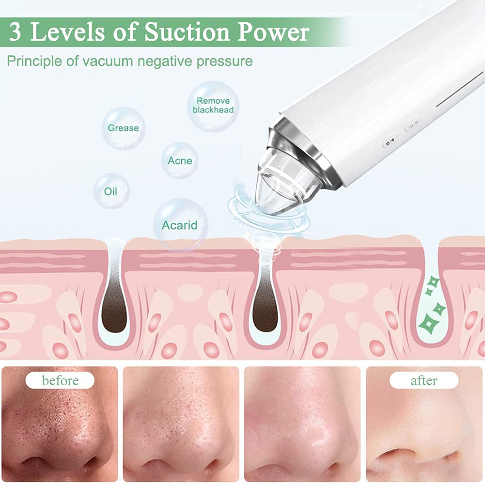Blackhead Remover Pore Vacuum, ?[FDA Certification] ? WiFi Visible Facial Pore Cleanser with HD Camera Pimple Acne Comedone Extractor Kit with 6