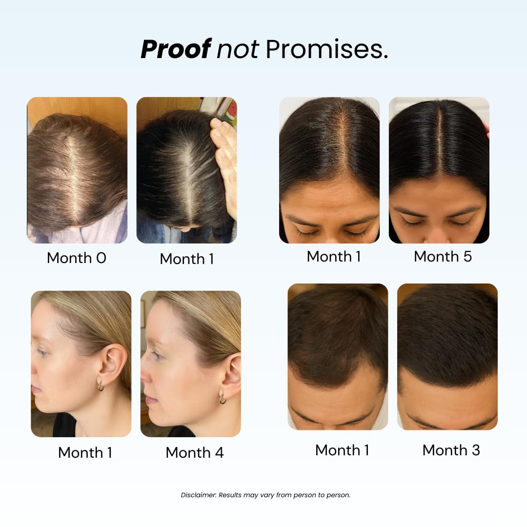Growplex Revive Shampoo & Replenish Conditioner Bundle, Biotin Scalp Care System for Men & Women, Supports Fuller Thicker-Looking Hair Daily
