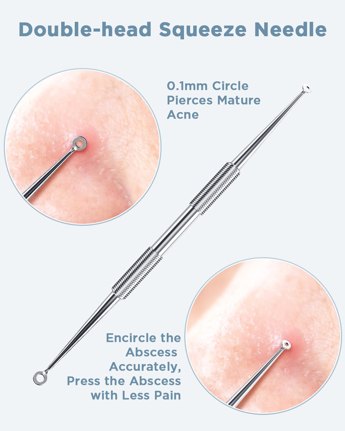 BESTOPE Blackhead Remover Blackhead Removal Pimple Comedone Extractor Tool - Treatment for Blemish Whitehead Popping Zit Removing with Metal Case