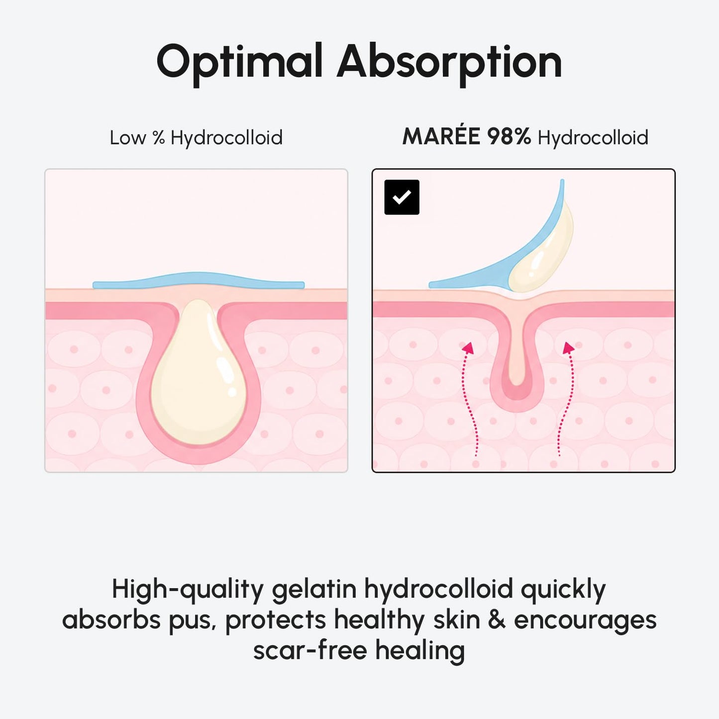 MAREE Invisible Pimple Patches 2 PACK - Clear Pimple Patches for Face - Hydrocolloid Acne Patches Anti Blemish - Zit Stickers for Face - Parches Para Beauty and Personal Care MAREE