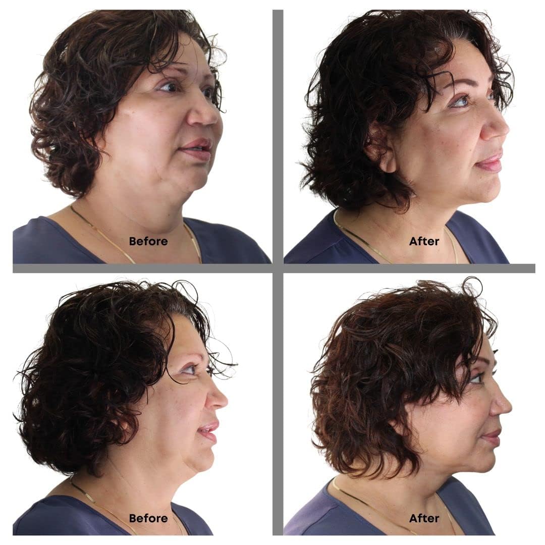 Bring It Up Instant Neck Lift Tape 30 Day Supply, Transparent Neck Lifting Anti Wrinkle Stickers - Tones Sagging Necklines Instantly - Made in USA