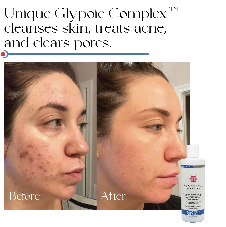 Rx Systems PF Reparative Facial Cleanser 8 oz, Repairs Skin, Clears away Oil and Dirt Build Up, Prevents Acne and Clogged Pores