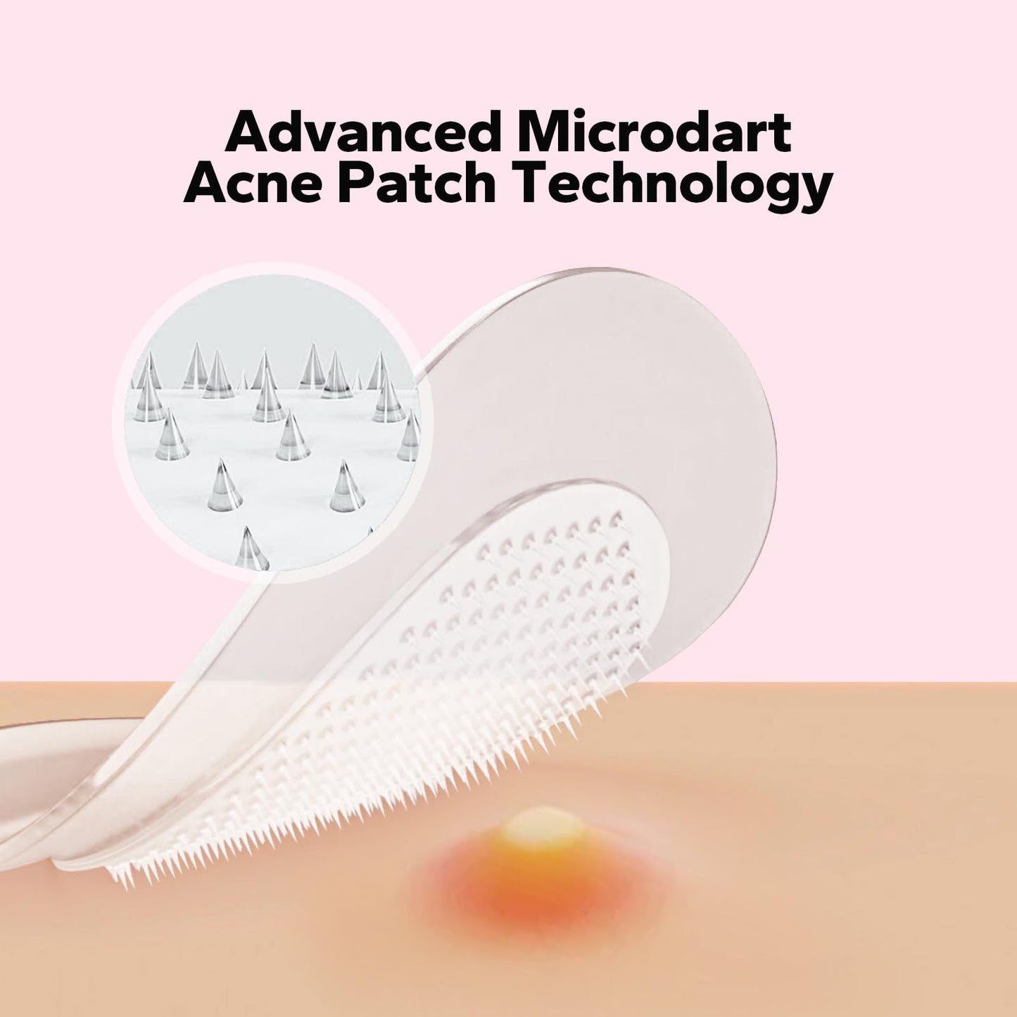 CharmCherry Pimple Patches for Face (18 Count), Microdart Acne Patches, Hydrocolloid Blemish Spot with Salicylic Acid, Fast-Acting for Early Stage