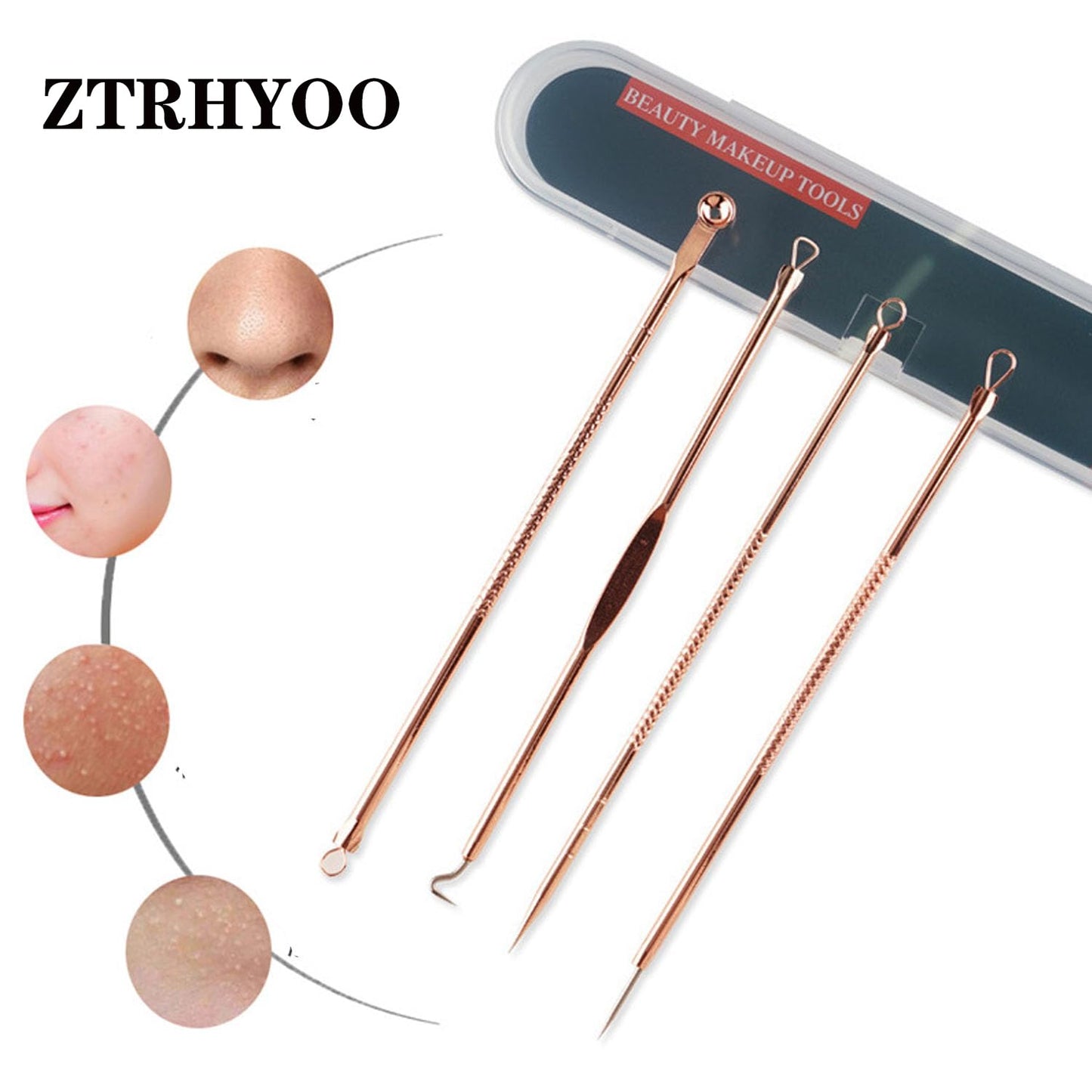 ZTRHYOO Blackhead Remover Pimple Comedone Extractor Tool Best Acne Removal Kit - Treatment for Blemish, Whitehead Popping, Zit Removing for Risk Free Beauty and Personal Care ZTRHYOO