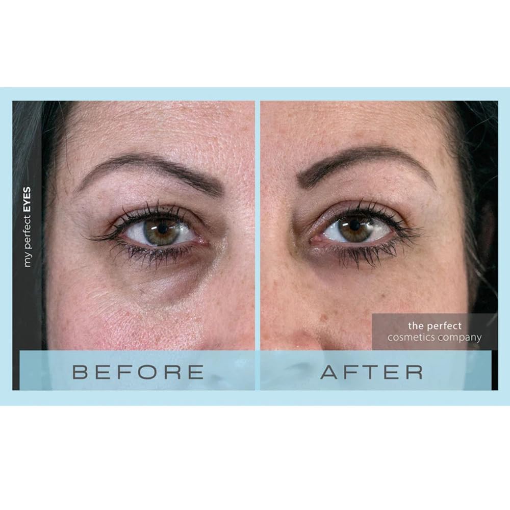My Perfect Eyes by Penny Lane | Anti-Aging Eye Cream for Dark Circles & Puffiness | Instant Firming Treatment for Wrinkles & Fine Lines | Undereye