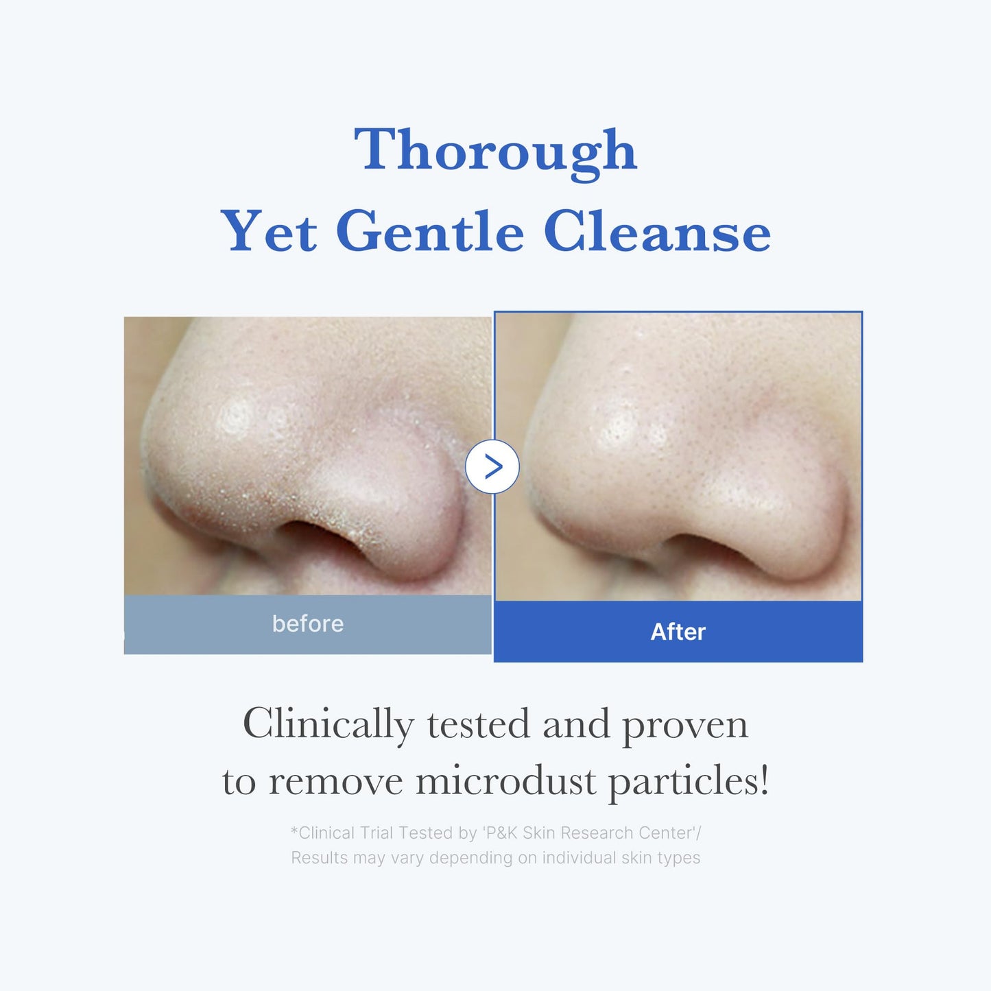 medicube Facial Cleanser Zero Foam Cleanser for Pore & Excess Oil Care Beauty and Personal Care medicube