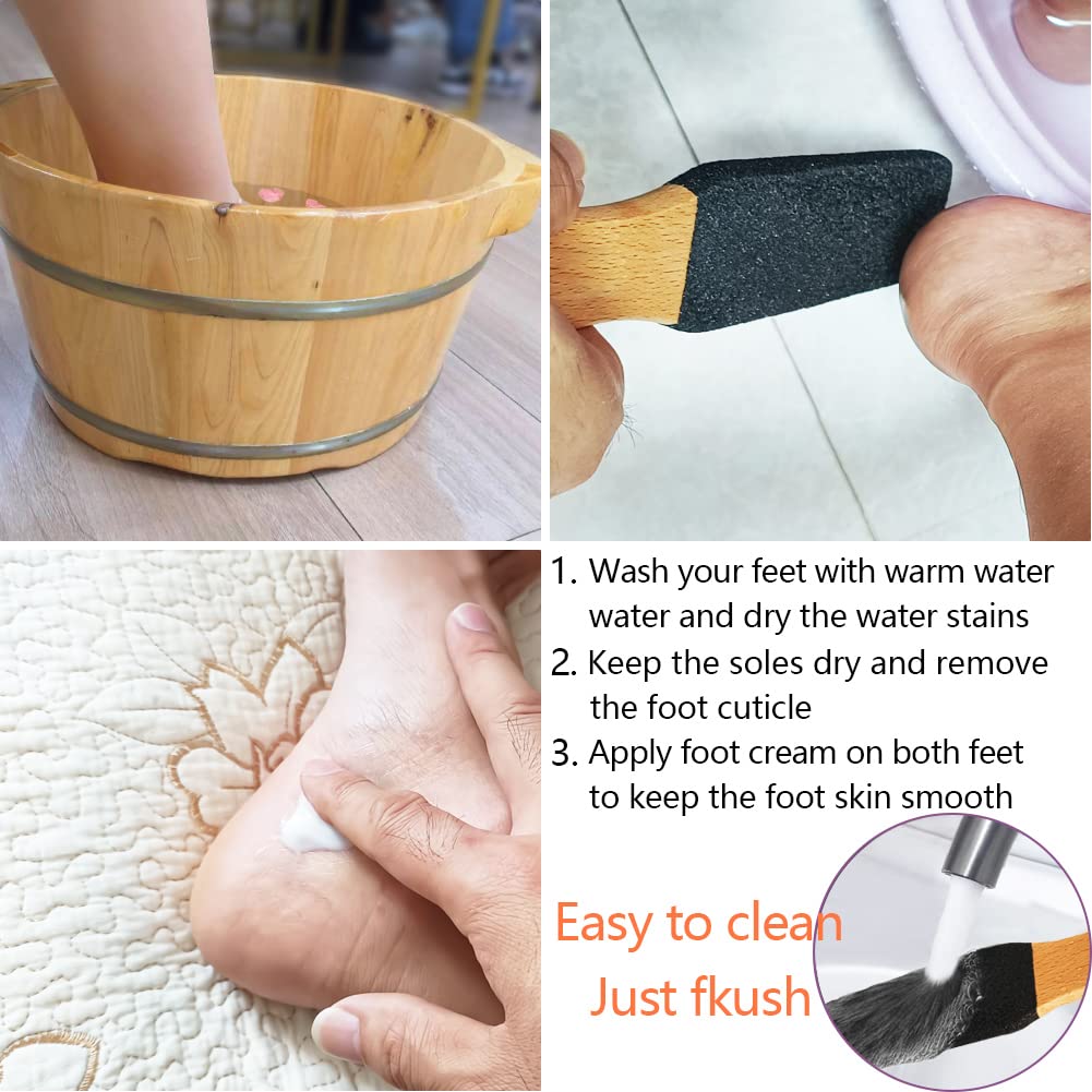 TOPMEET Foot File/Rasp,Exfoliator Pedicure Tool Foot Callus Remover Scrubber for Dead Skin,Corn and Hard Skin - Pumice Stone for Cracked Feet,Heels