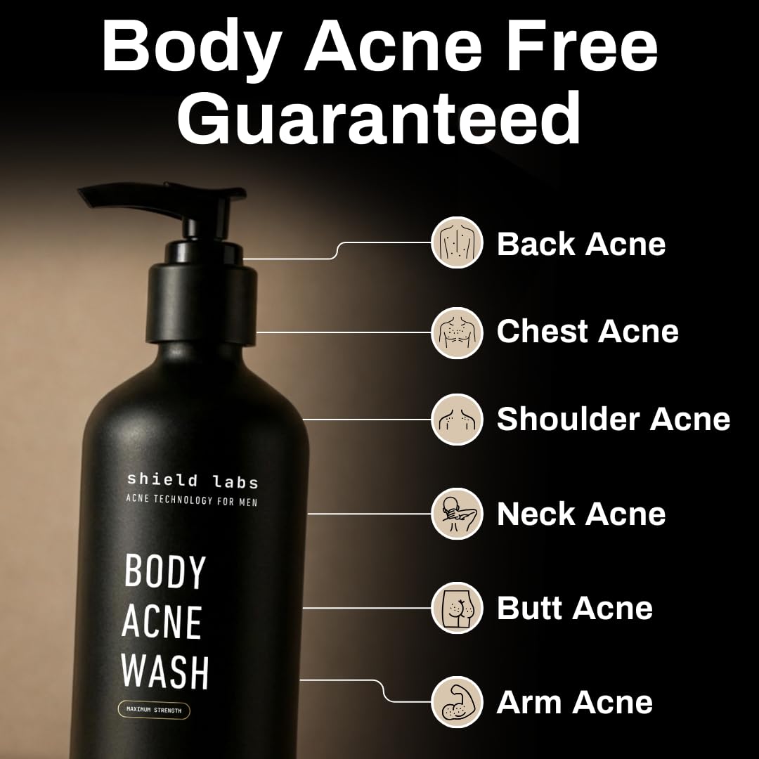 Shield Body Acne Wash for Back, Chest & Shoulders - Men's 10% Benzoyl Peroxide Body Wash, Clears Breakouts & Acne Scars - Unscented with Niacinamide Beauty and Personal Care Shield
