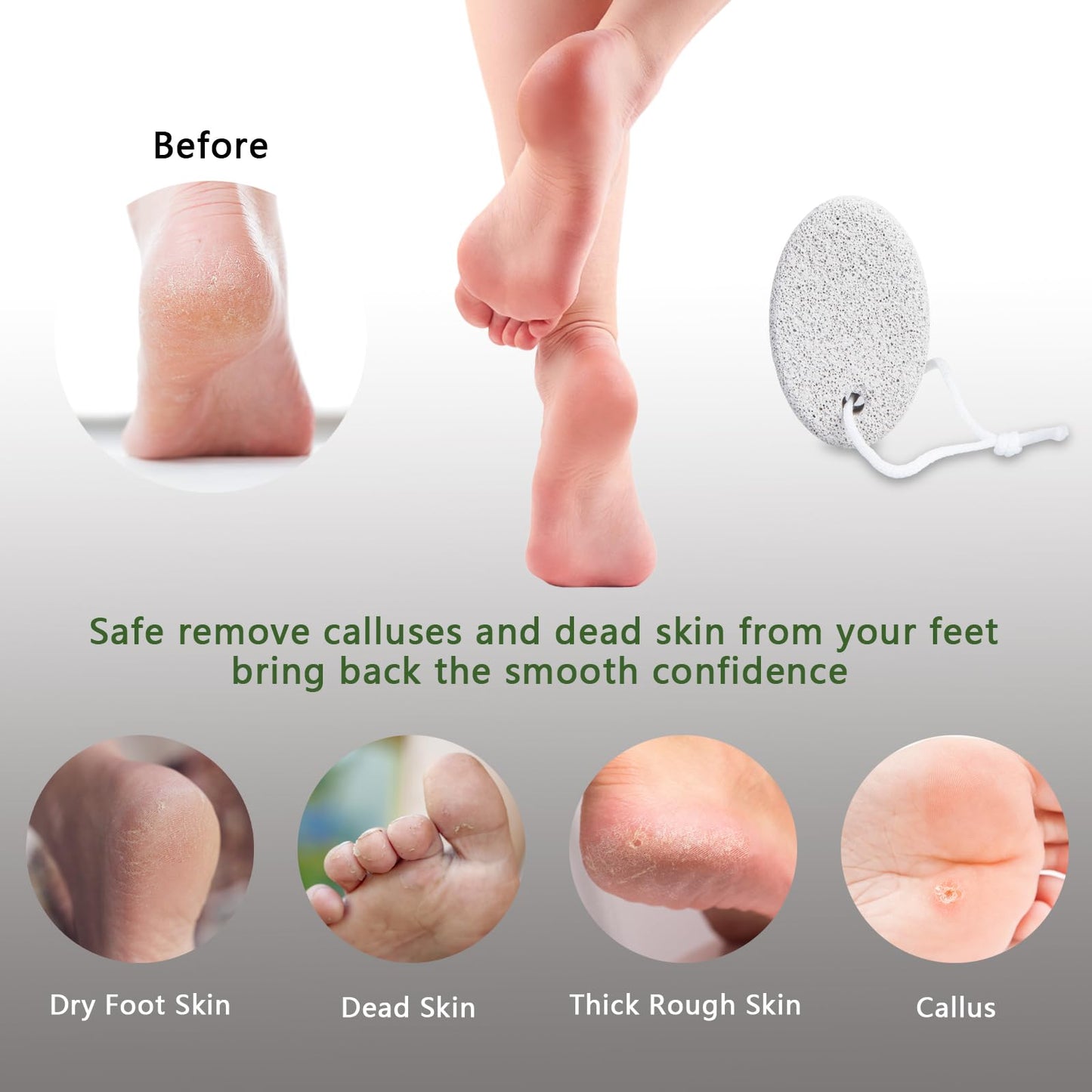 Natural Foot Pumice Stone for Feet, Borogo 2-Pack Lava Pedicure Tools Hard Skin Callus Remover for Feet and Hands - White&Red Beauty and Personal Care Borogo