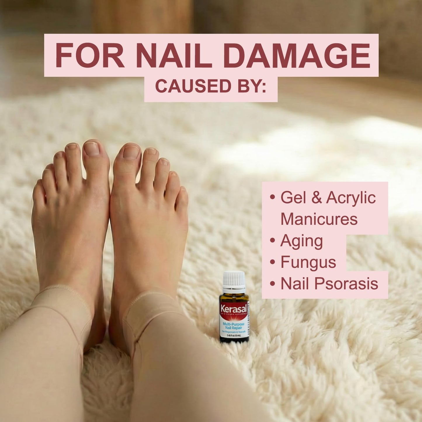 Kerasal Multi-Purpose Nail Repair, Nail Solution for Discolored and Damaged Nails, 0.43 fl oz Beauty & Personal Care Kerasal