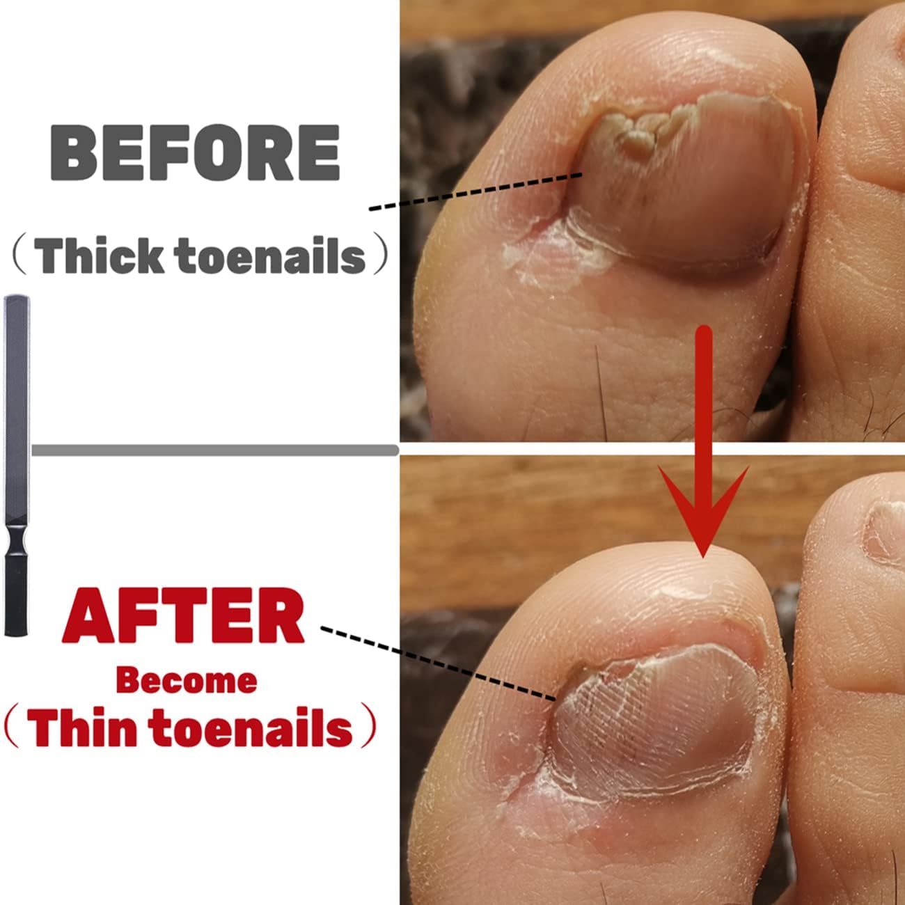 IDOU Toe Nail Files for Thick Nails,Stainless Steel 4 Sides 7 inch Length,Nail Files for Men Seniors & Dogs