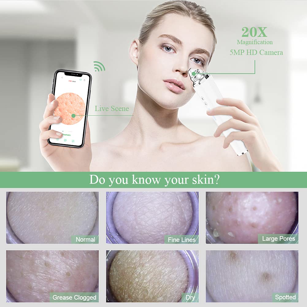 Blackhead Remover Pore Vacuum, ?[FDA Certification] ? WiFi Visible Facial Pore Cleanser with HD Camera Pimple Acne Comedone Extractor Kit with 6