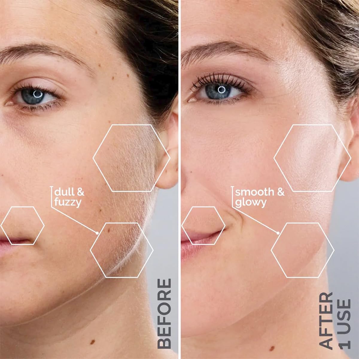 Michael Todd Beauty Sonicsmooth Dermaplane Razor for Women Face Beauty and Personal Care MICHAEL TODD