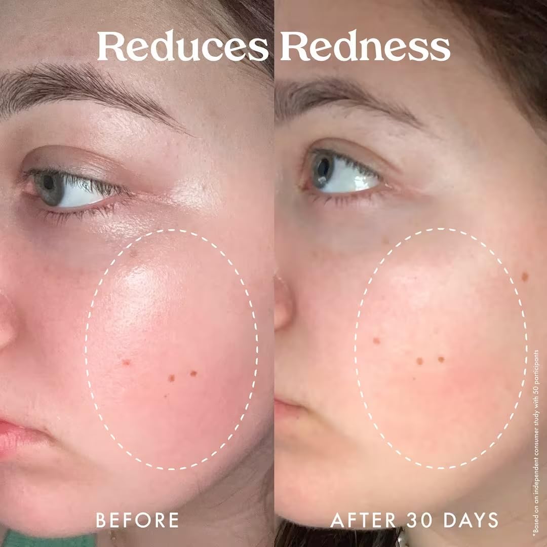 Kopari Star Bright Vitamin C Moisturizer with Starfruit & Niacinamide, Lightweight Formula Melts Into Skin, Brighten & Even Complexion, 1.7oz