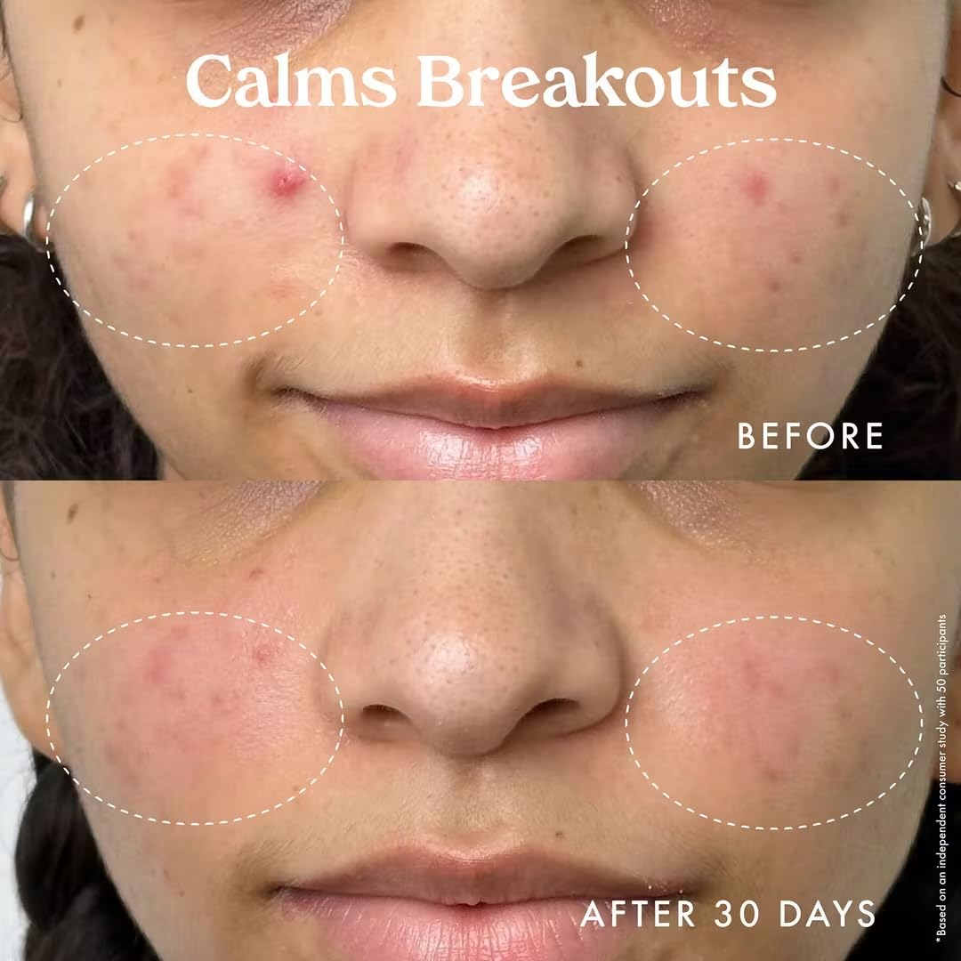 Kopari Star Bright Vitamin C Moisturizer with Starfruit & Niacinamide, Lightweight Formula Melts Into Skin, Brighten & Even Complexion, 1.7oz