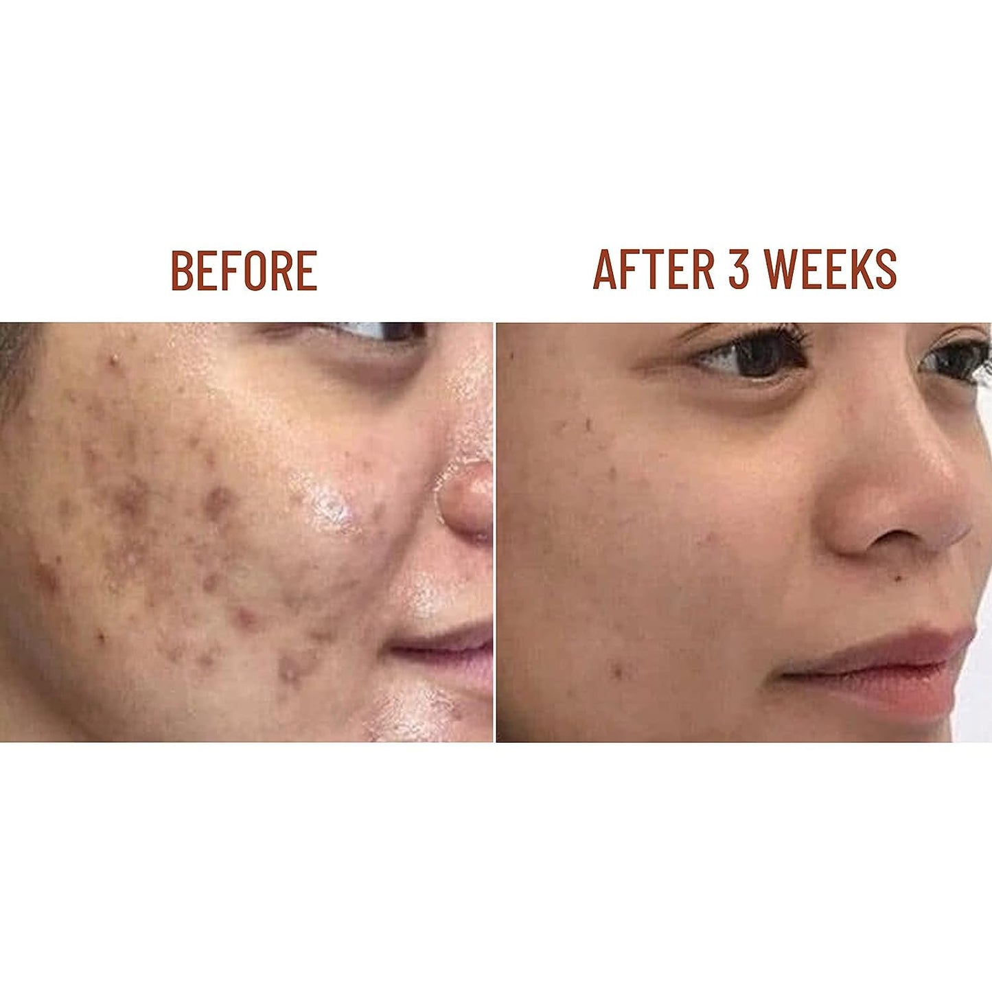 ABERA Nano Turmeric Vitamin C Serum, Nourish and Brighten Skin Tone, Reduce Dark Spots, Acne Bruise Relief, Restore Skin Strength, Skin Care Oil