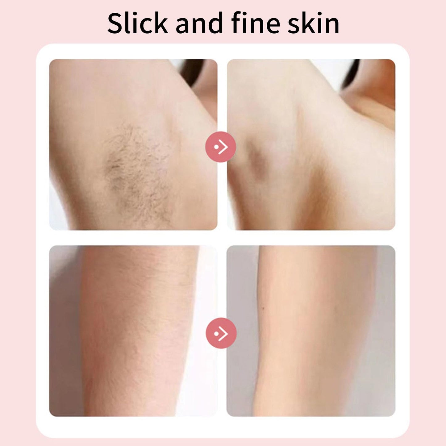 ZJchao 3 in 1 Hair Removal Device, Hair Removal Epilator for Women, Women Depilator IPX4 Water Proof Electric Epilator Trimmer with Foot File Head Beauty and Personal Care ZJchao