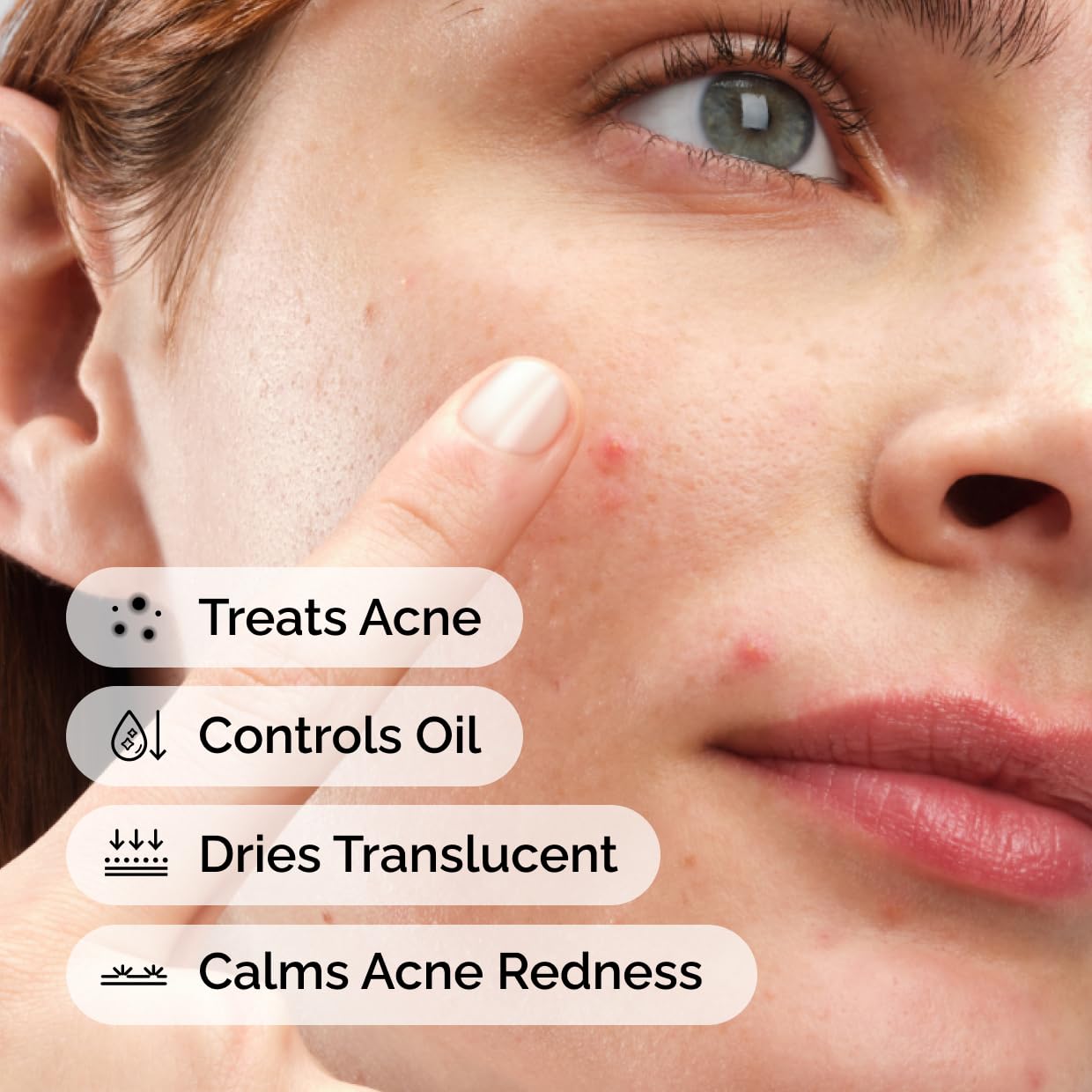 The Ordinary Sulfur 10% Powder-to-Cream Acne Spot Treatment Concentrate, Reduces Pimple Size and Zit Redness, 0.18 Oz Beauty and Personal Care The Ordinary