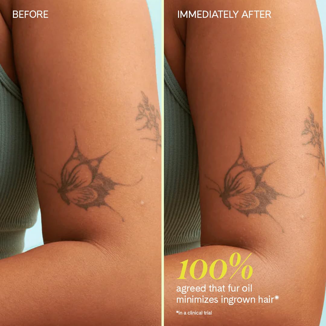 Fur Oil Ingrown Hair Treatment – Jojoba & Grape Seed Moisturizer with Clary Sage & Tea Tree to Prevent & Treat Ingrown Hairs