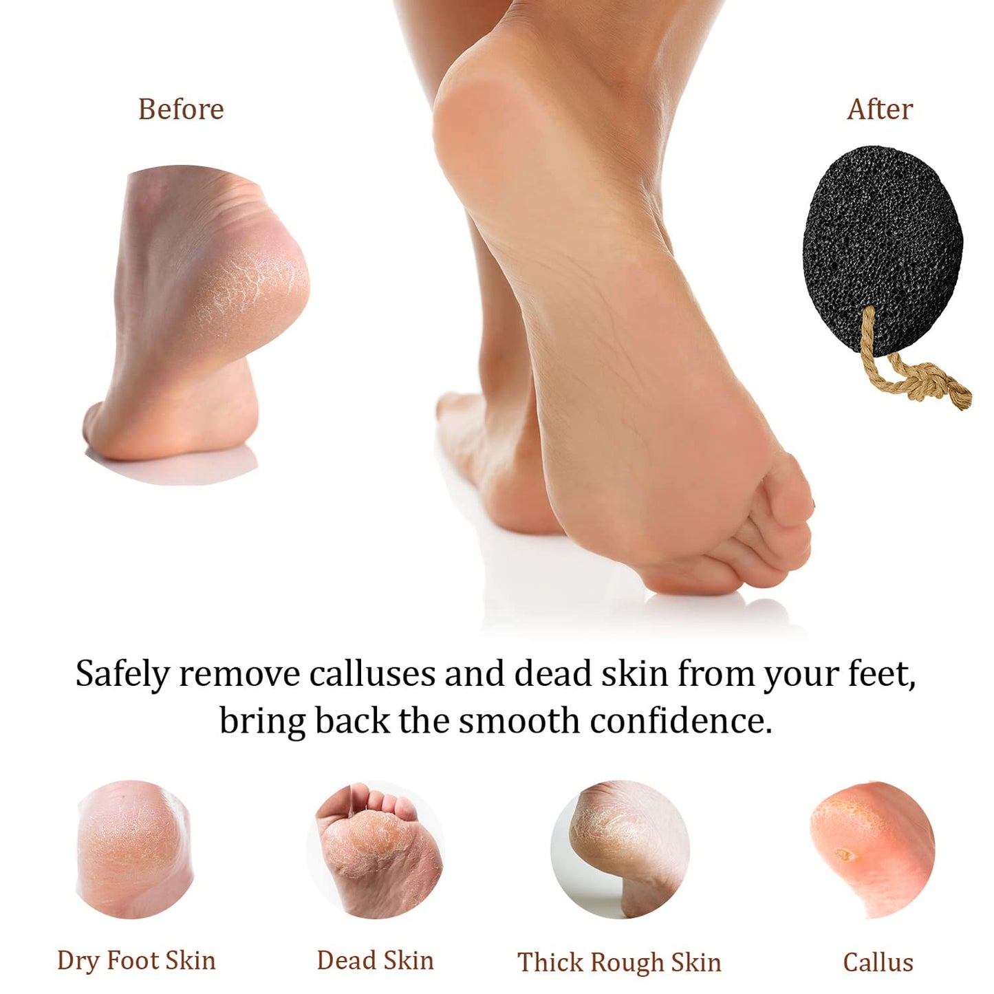 Pumice Stone - Natural Earth Lava Black - Callus/Corn Remover for Feet Heels and Palm - Pedicure Exfoliation Tool - Dry Dead Skin Scrubber - Health Beauty and Personal Care Pumice Valley