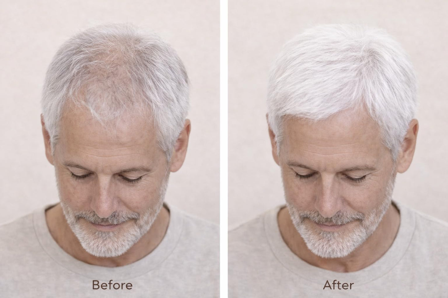 diCESARE NEW Silver Hair Building Fiber - Fuller Looking Gray Hair - Lightweight Coverage for Thinning Areas - NOW IN 2 SIZES