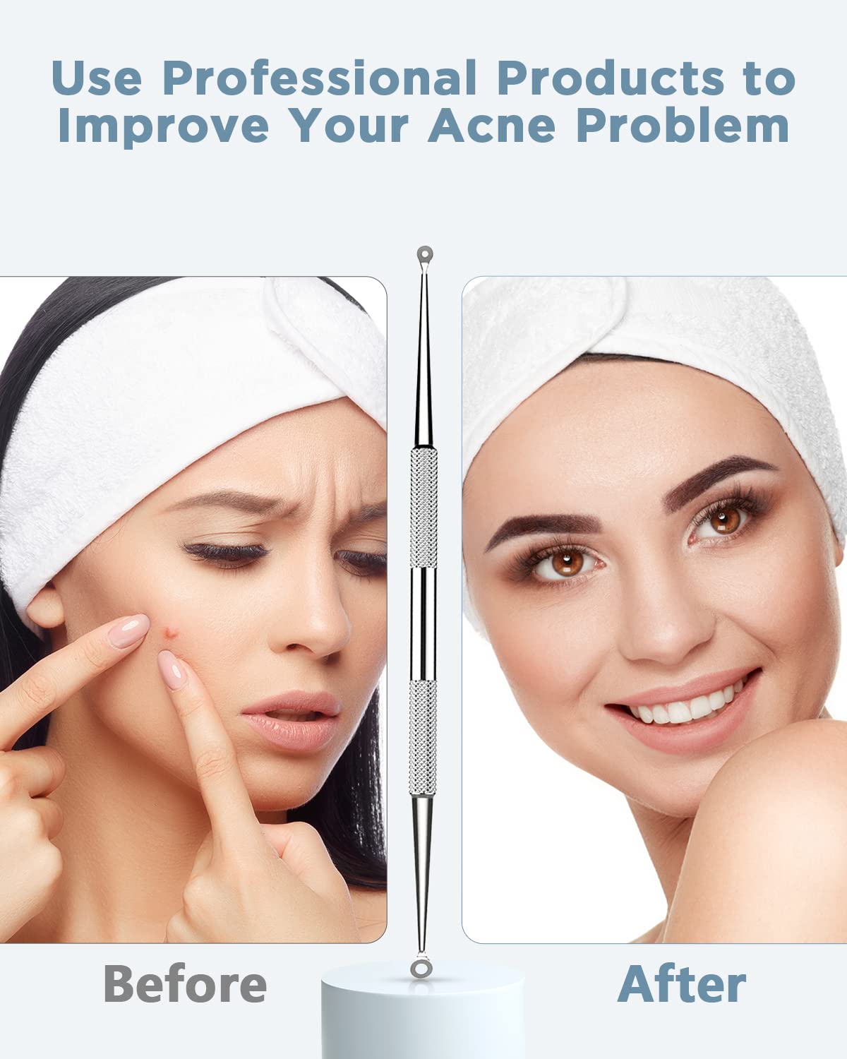BESTOPE Blackhead Remover Blackhead Removal Pimple Comedone Extractor Tool - Treatment for Blemish Whitehead Popping Zit Removing with Metal Case