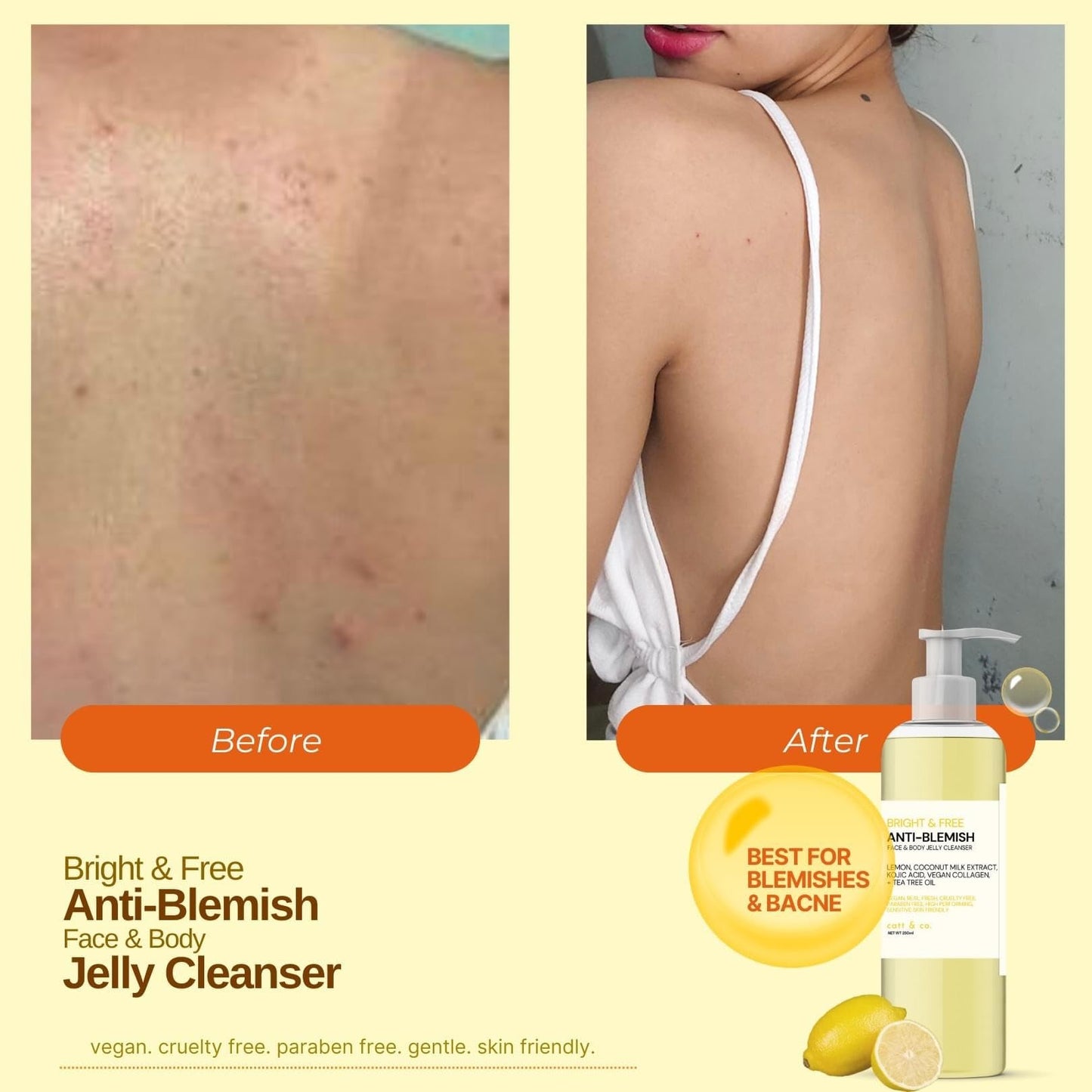 Catt & co. Bright and Free ANTI- BLEMISH FACE & BODY JELLY CLEANSER 250ML