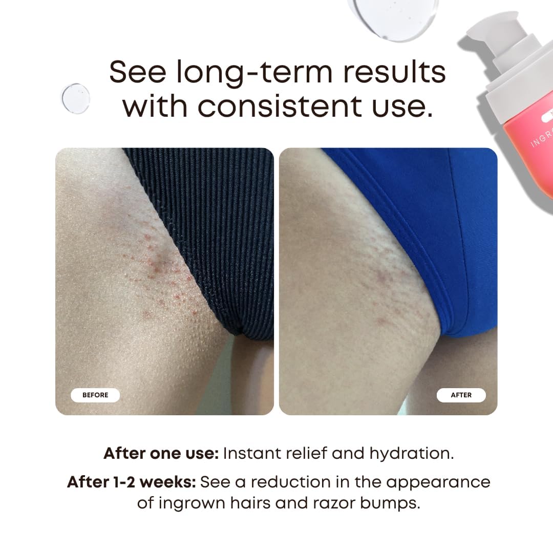 Bushbalm Ingrown Hair Oil - Helps Prevent and Repair Skin from Ingrown Hairs, Razor Burn & Underarm Bumps - Soothe Skin from Post Shave Itchiness Beauty and Personal Care Bushbalm